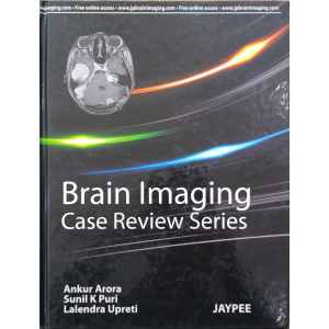Brain Imaging | Case Review Series | Jaypee