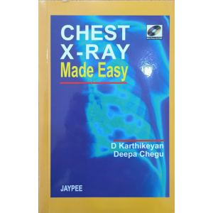 Chest X-Ray Made Easy | Jaypee
